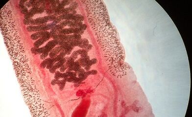 Anqilostomosis di manusa