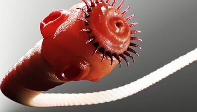 jinis parasit dina awak manusa