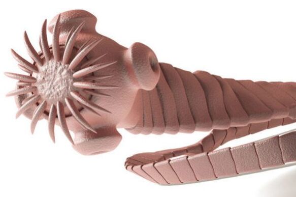 parasit ti awak manusa