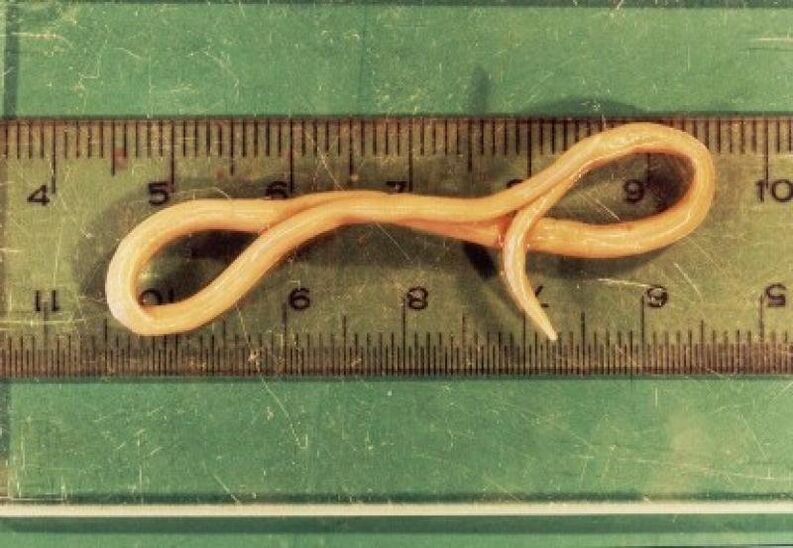 parasit roundworm tina awak manusa