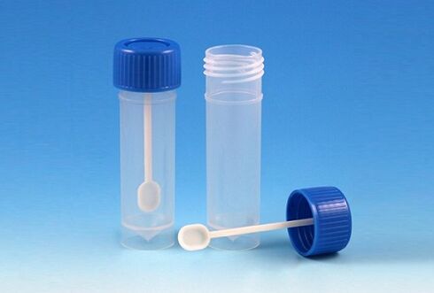 jar pikeun analisis stool pikeun parasit